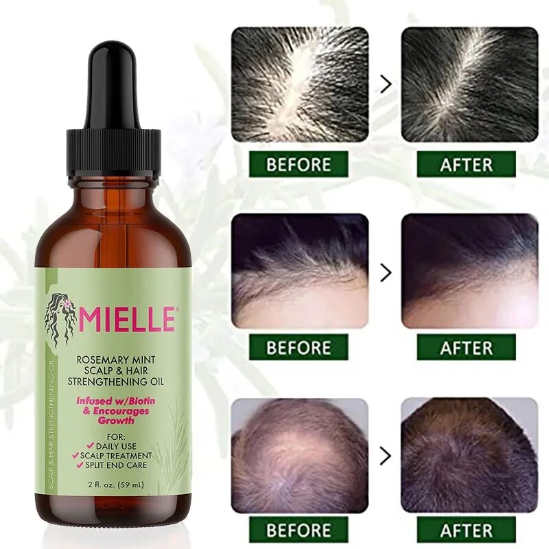 Hair Growth Essential Oil Rosemary Mint Hair Strengthening Oil Nourish Treatment Split Ends Repair Dry Mielle Organics Hair care
